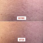 Exfoliante corporal, borra protuberancias, con 10 % AHA, vegano, para descongestionar los poros y exfoliar suavemente la piel, 8 onzas - Imagen 3