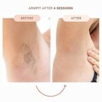 Sistema de depilación IPL – Depilación láser permanente en casa para cara, cuerpo, línea de bikini – Dispositivo de depilación para reducción de cabello sin dolor en mujeres y hombres - Imagen 7