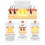 Sistema de depilación IPL – Depilación láser permanente en casa para cara, cuerpo, línea de bikini – Dispositivo de depilación para reducción de cabello sin dolor en mujeres y hombres - Imagen 4