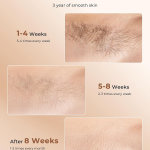 Depilación láser para mujeres, 97.6% de reducción de vello en 2 sesiones, dispositivo de depilación IPL de enfriamiento de hielo a 41.0 °F, depilación en casa para piernas, bikini, axilas faciales (dorado) - Imagen 2