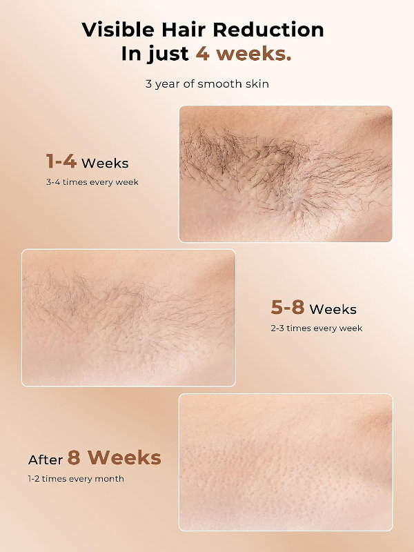 Depilación láser para mujeres, 97.6% de reducción de vello en 2 sesiones, dispositivo de depilación IPL de enfriamiento de hielo a 41.0 °F, depilación en casa para piernas, bikini, axilas faciales (dorado) - Imagen 2
