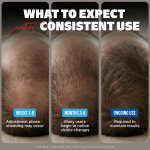 Minoxidil - Tratamiento líquido extra fuerte para el crecimiento del cabello para hombres, solución tópica al 5%, suministro de 6 meses, aplicador cuentagotas y guía de instrucciones gratuita incluida - Imagen 3